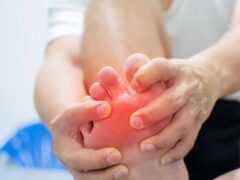 Cara Hilangkan Gout