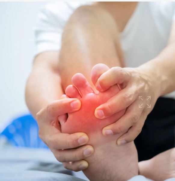 Cara Hilangkan Gout